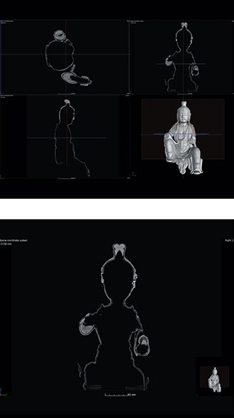 컴퓨터 단층 촬영 사진